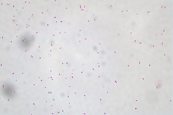 Akkermansia Muciniphila AKK016 AKK Off Weiß bis hellgrau Pulver/ Probiotika